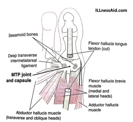 anatomy of turf toe