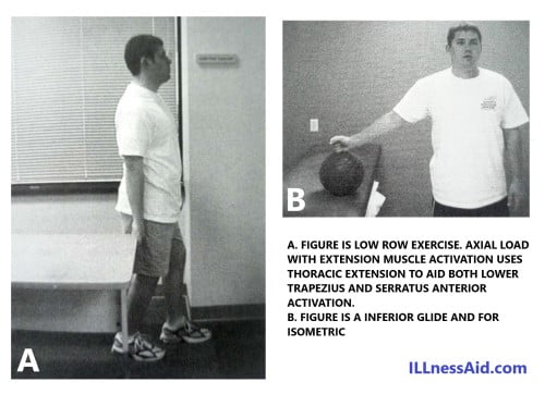 Acute exercises for scapular dyskinesis