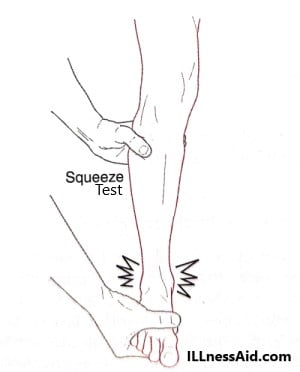 Squeeze test