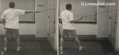Fencing for scapular dyskinesis