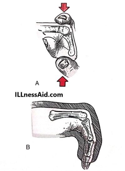 maneuver of jahs