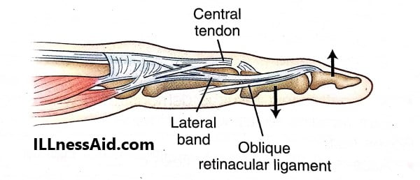 pathomechanics OF DEFORMITY