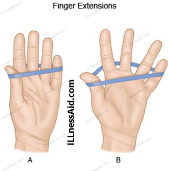 finger extensions
