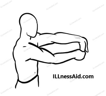 wrist flexor stretch 