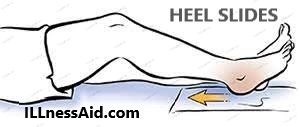 Segond fracture exercise - HEEL SLIDES 
