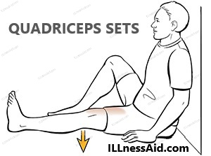 quadriceps sets for segond fracture 
